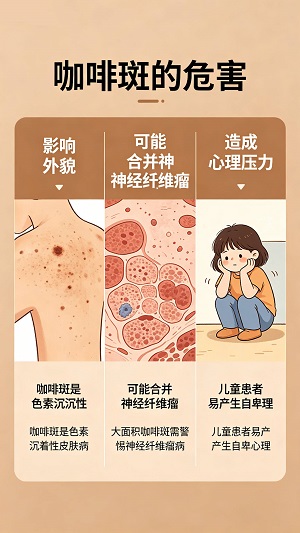 医疗资讯排名一览：咖啡斑需要治疗多长时间？